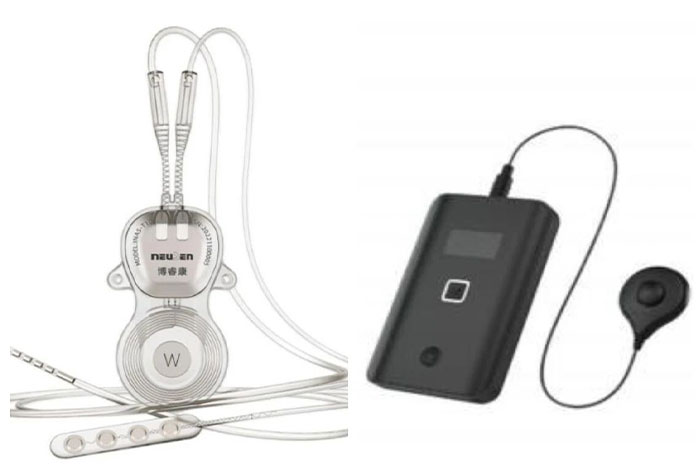 科研动态丨我院成功完成首例脑机接口闭环脑部采集刺激系统(ANS)治疗药物难治性癫痫临床试验项目手术